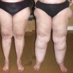 photo of 4 pairs of legs in various weights