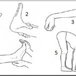 Beighton 9 pt scoring illustration